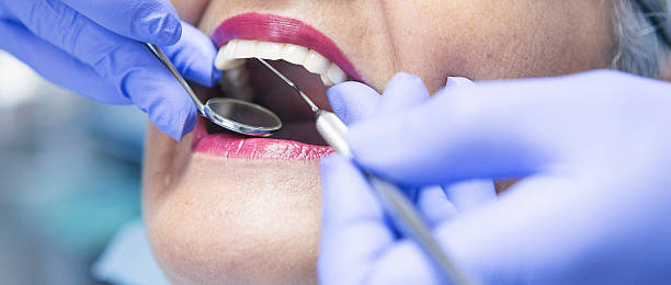 Best Dentist for Tooth Abscess  in Beachwood, OH